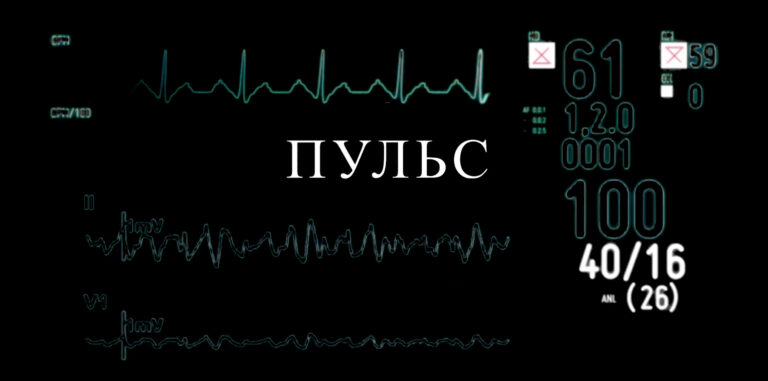 Пульс | Сахарный диабет