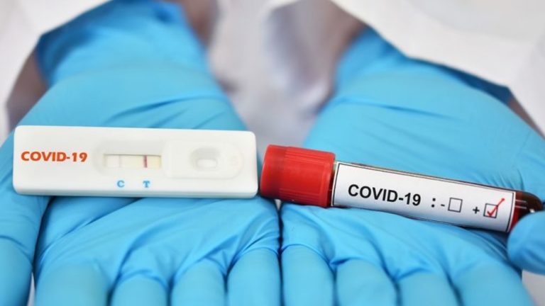 Число больных короновирусом продолжает снижаться: 280 случаев за прошлую неделю