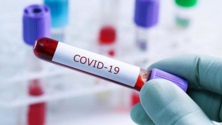 За прошлую неделю выявлено почти 1000 случаев COVID-19 и 17 смертей: данные Минздрава