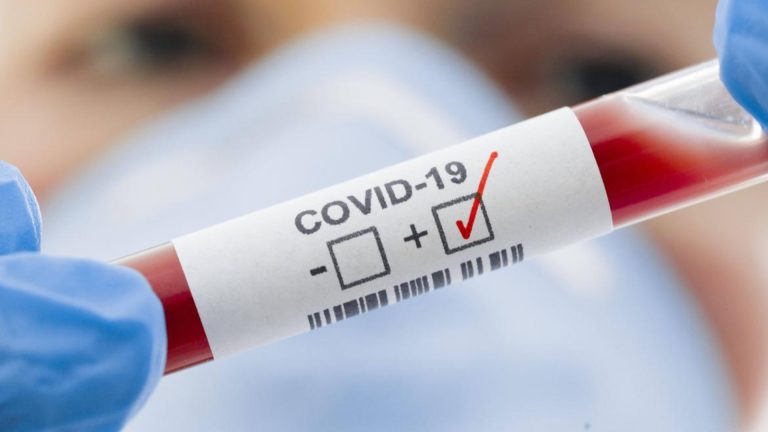 В Молдове за неделю вдове увеличилось число заболевших COVID-19, два человека умерли